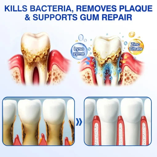 Periodontal Repair Gel